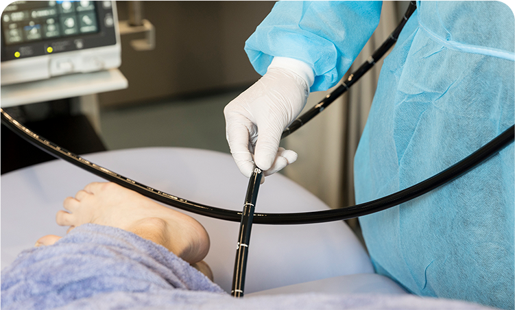 検査中の大腸ポリープ切除も可能な痛みの少ない大腸カメラ検査