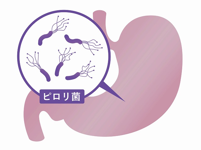 ピロリ菌と機能性ディスペプシアについて